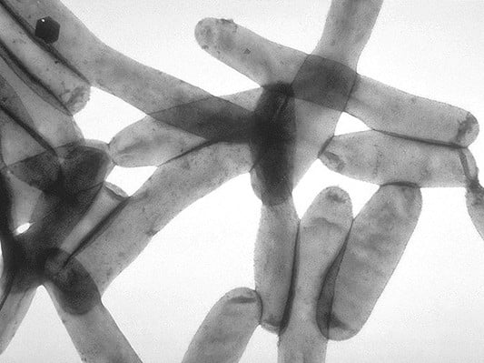 Legionella pneumophila