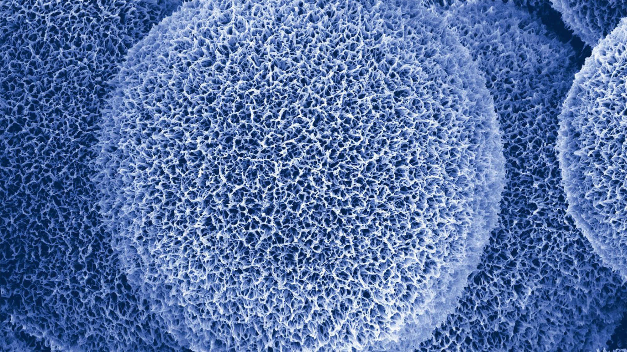 Aerogel Dämmstoffe Dämmstoffe