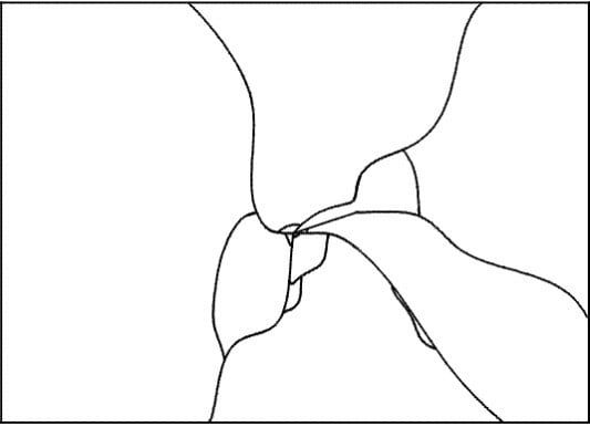 Schematische Darstellung eines Glasbruchs durch lokale Stoßeinwirkung in der Mitte einer Floatglasscheibe